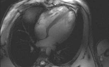 Researchers at UQ’s Centre for Advanced Imaging have begun performing the Southern Hemisphere’s most advanced cardiac imaging. Researchers at UQ’s Centre for Advanced Imaging have begun performing the Southern Hemisphere’s most advanced cardiac imaging.